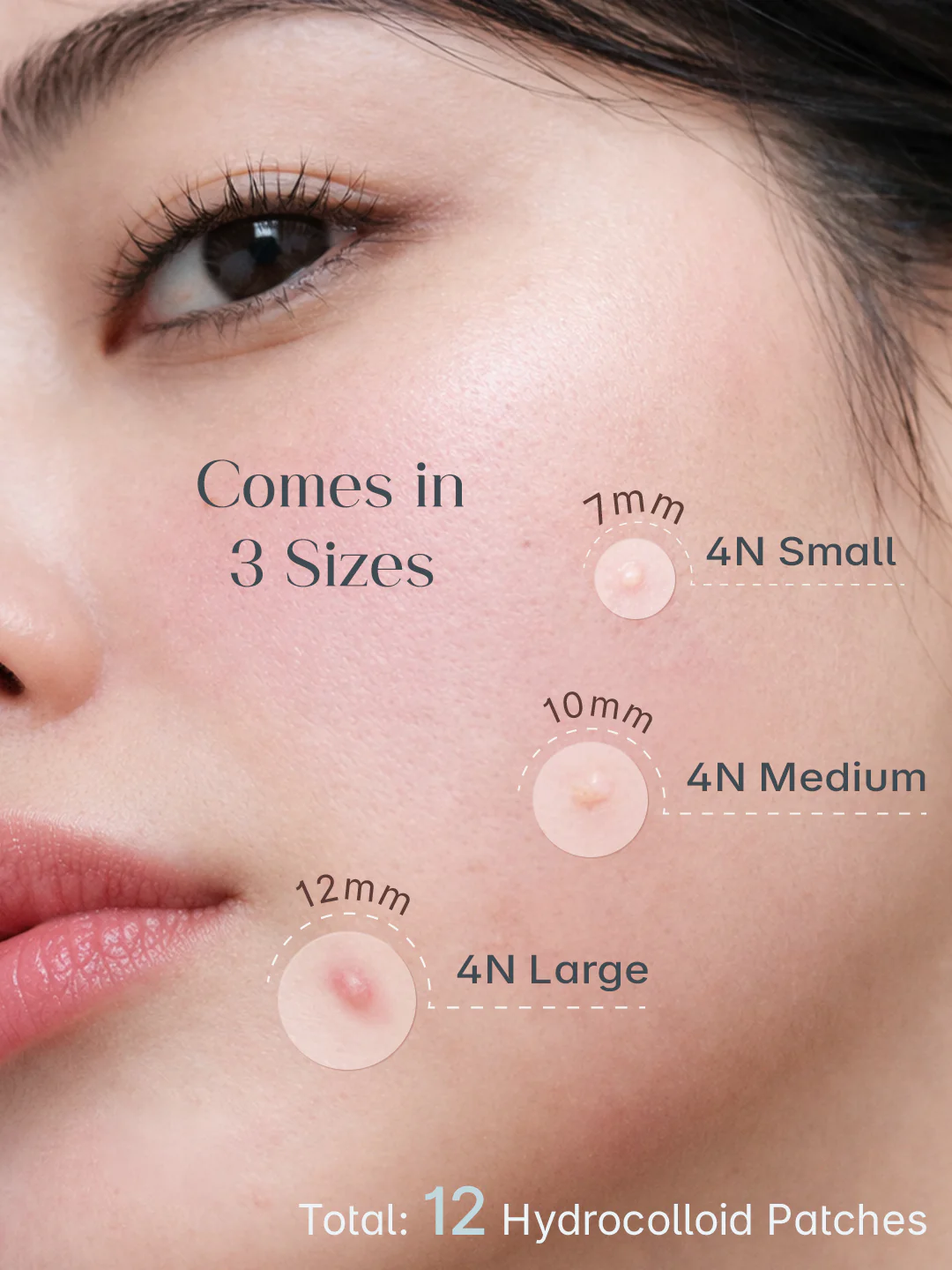 Seoulskin Acne  Pimple Patch - 12  dot - Image 6