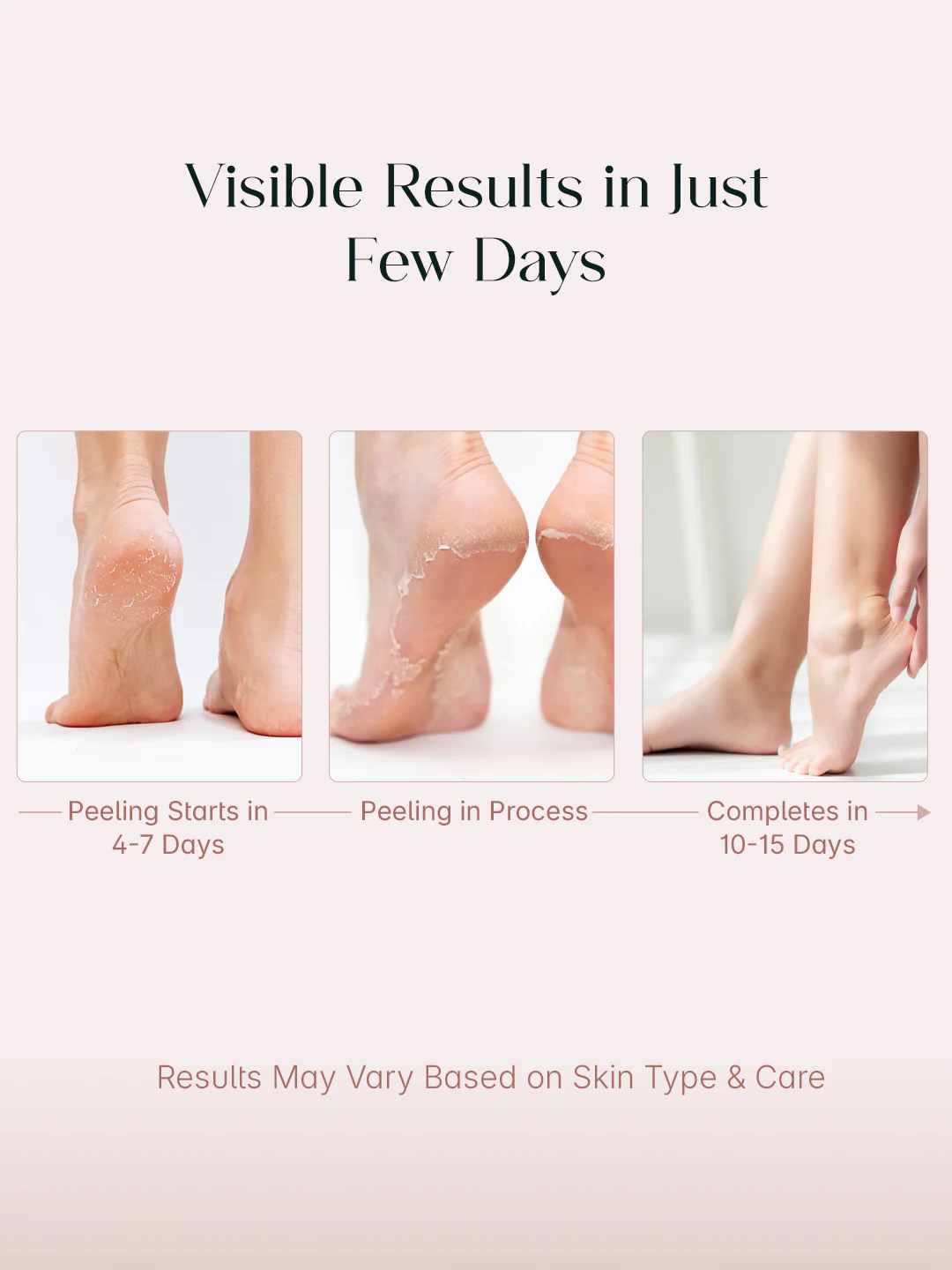 SeoulSkin Glycolic Acid Foot Peeling Mask | Pack Of 2 - Image 4