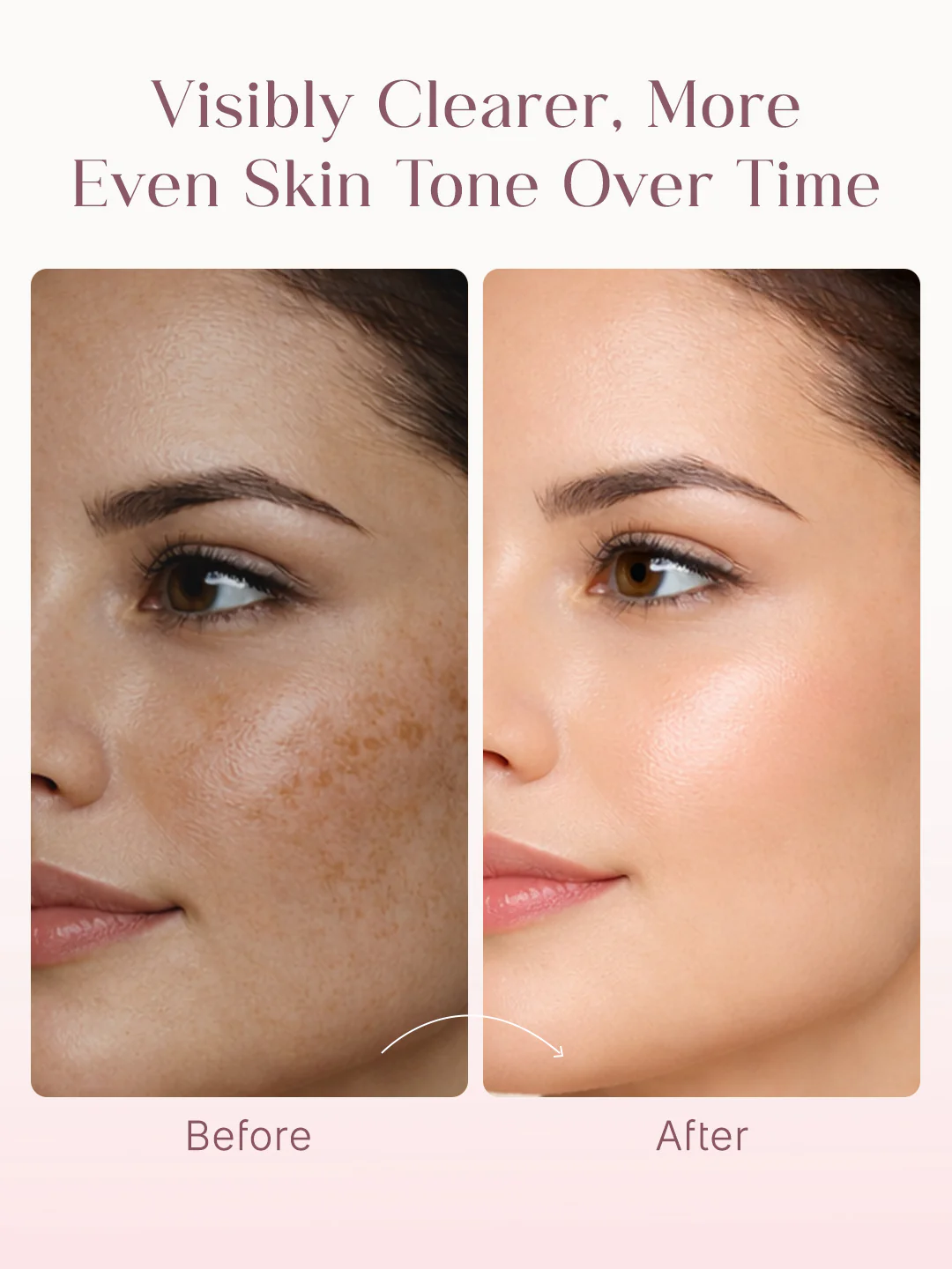 Seoulskin Kojic Acid Skin Lightening Cream pack of 2 - Image 4