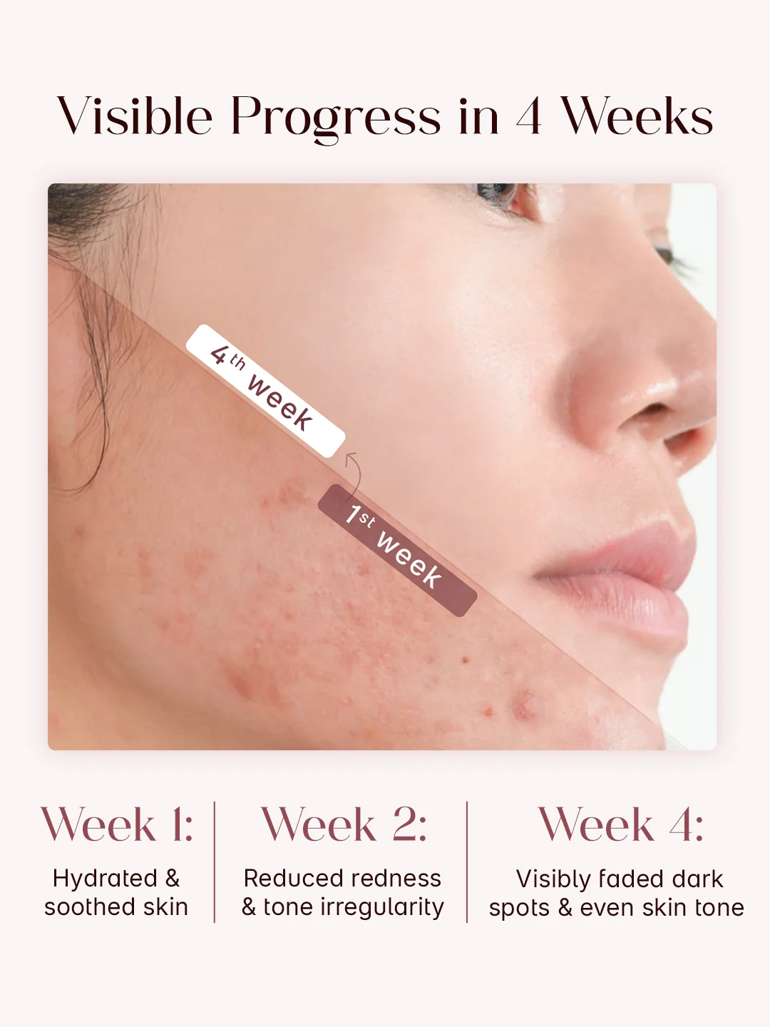 Seoulskin Red Serum (Niacinamide 5 +TXA 3) 30ml - Image 5