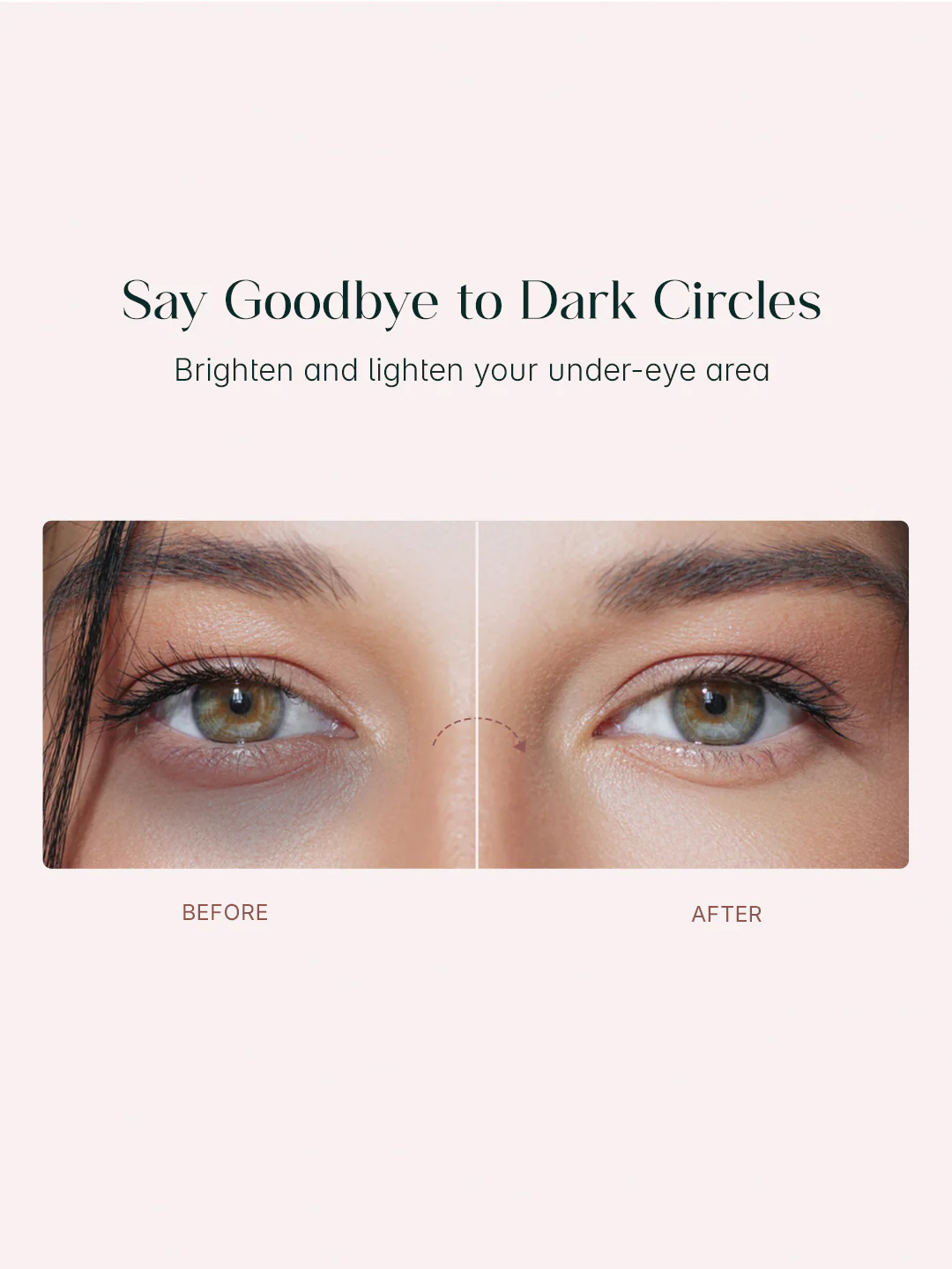 Seoulskin Snail Mucin Under Eye Patches - Image 3