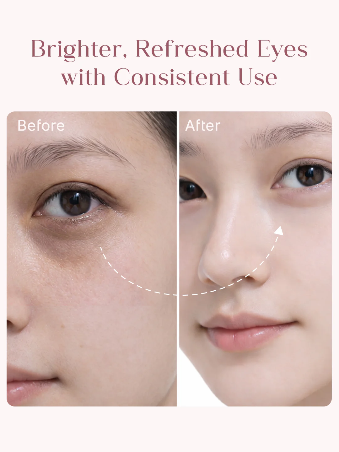 Seoulskin Under Eye Cream (15ml) - Image 4