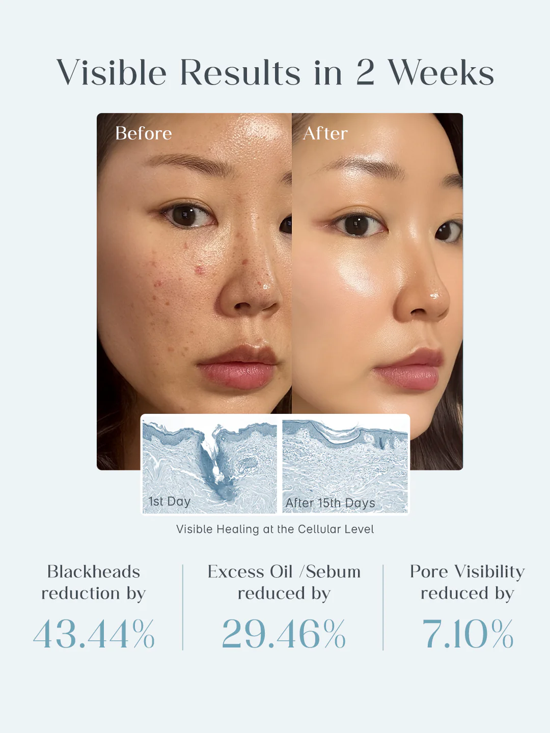 Seoulskin Zero Pore Pads - Image 5